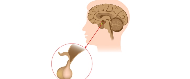 ما هي الغدة النخامية وما يرتبط بها من أمراض؟