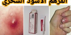 تجربتي مع المرهم الاسود لعلاج الخراج؟