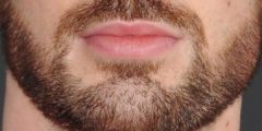 تجربتي مع فراغات الذقن وطريقة تكثيف شعر الذقن بطرق طبيعية؟