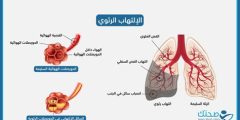 أعراض إلتهاب الرئة الحاد عند كبار السن وعلاجه