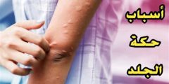 أسباب حكة الجسم واسرع طرق علاجها