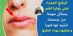 أسباب وعلاج حبوب الهربس في الفم