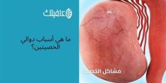 أسباب دوالي الخصيتين وافضل طرق علاجها