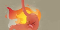 اسباب الحرقان في المعدة وعلاجه