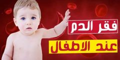 اسباب واعراض فقر الدم عند الرضع وعلاجه
