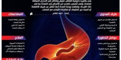 أهم اعراض جرثومة المعدة واسبابها وعلاجها