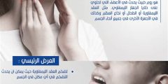 أهم امراض الغدد الليمفاوية الاعراض والوقايه والعلاج
