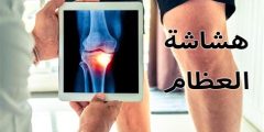 اذاعه عن هشاشة العظام للاطفال