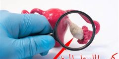 أسباب وجود ماء في الرحم أعراضه وعلاجه منزلياً