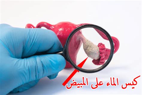 هناك كيس من الماء في الرحم