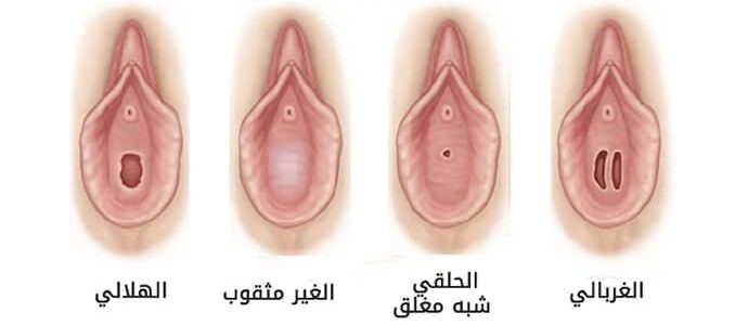 كيف عرفت أنك عذراء