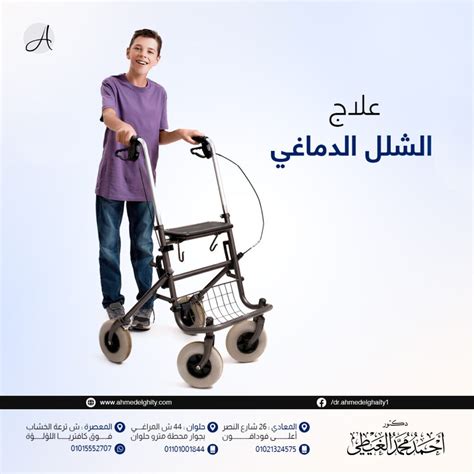 لدى Garink Lotus العديد من المزايا ، وأهمها لدى Garink Lotus العديد من المزايا ، وأهمها