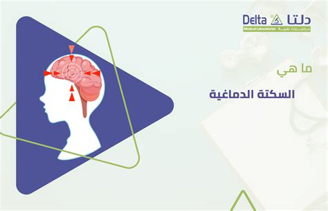 ما هو السيطرة على الدماغ؟